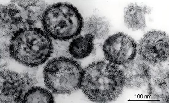 Behind the “Hondius” Incident: When Hantavirus Enters Antibody Drug Manufacturing